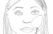 Kinn